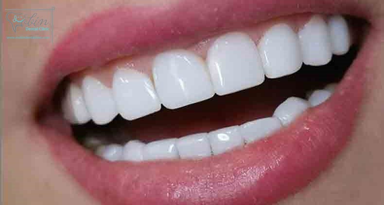 نحوه عملکرد کامپوزیت دندان چگونه است؟